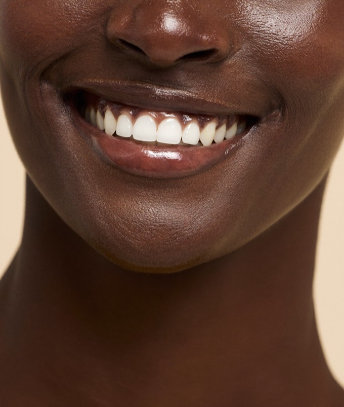 Close-up of a relaxed natural smile with bright, healthy teeth